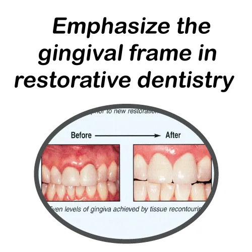 Esthetic Periodontal Procedures