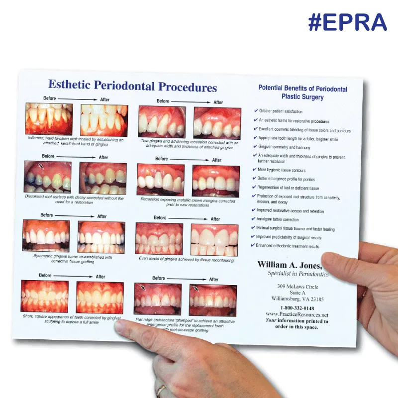 Esthetic Periodontal Procedures